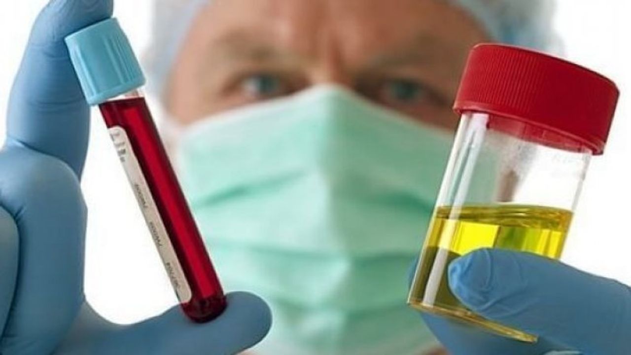 Hematüri Nedir? Belirtileri, Nedenleri ve Tedavi Yöntemleri